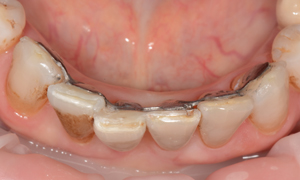 parodontologie-rouen-chirurgien-dentiste