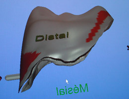 cabinet-implantologie-rouen4