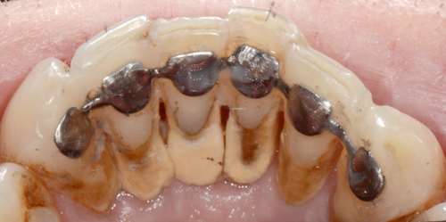 parodontologie-david-miniere-rouen1