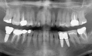 chirurgie-dentaire-rouen21