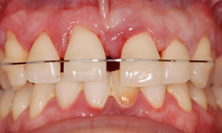 parodontologie-orthodontie-rouen1