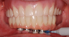chirurgie-dentaire-forge-les-eaux1