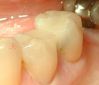 esthetique-dentaire-rouen1