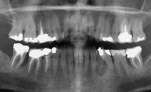 chirurgie-dentaire-rouen5