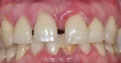 parodontologie-orthodontie-rouen